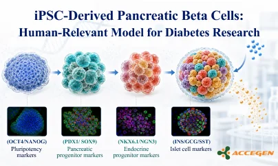 iPSC-Derived Pancreatic Beta Cells: A Human-Relevant Model for Diabetes Research